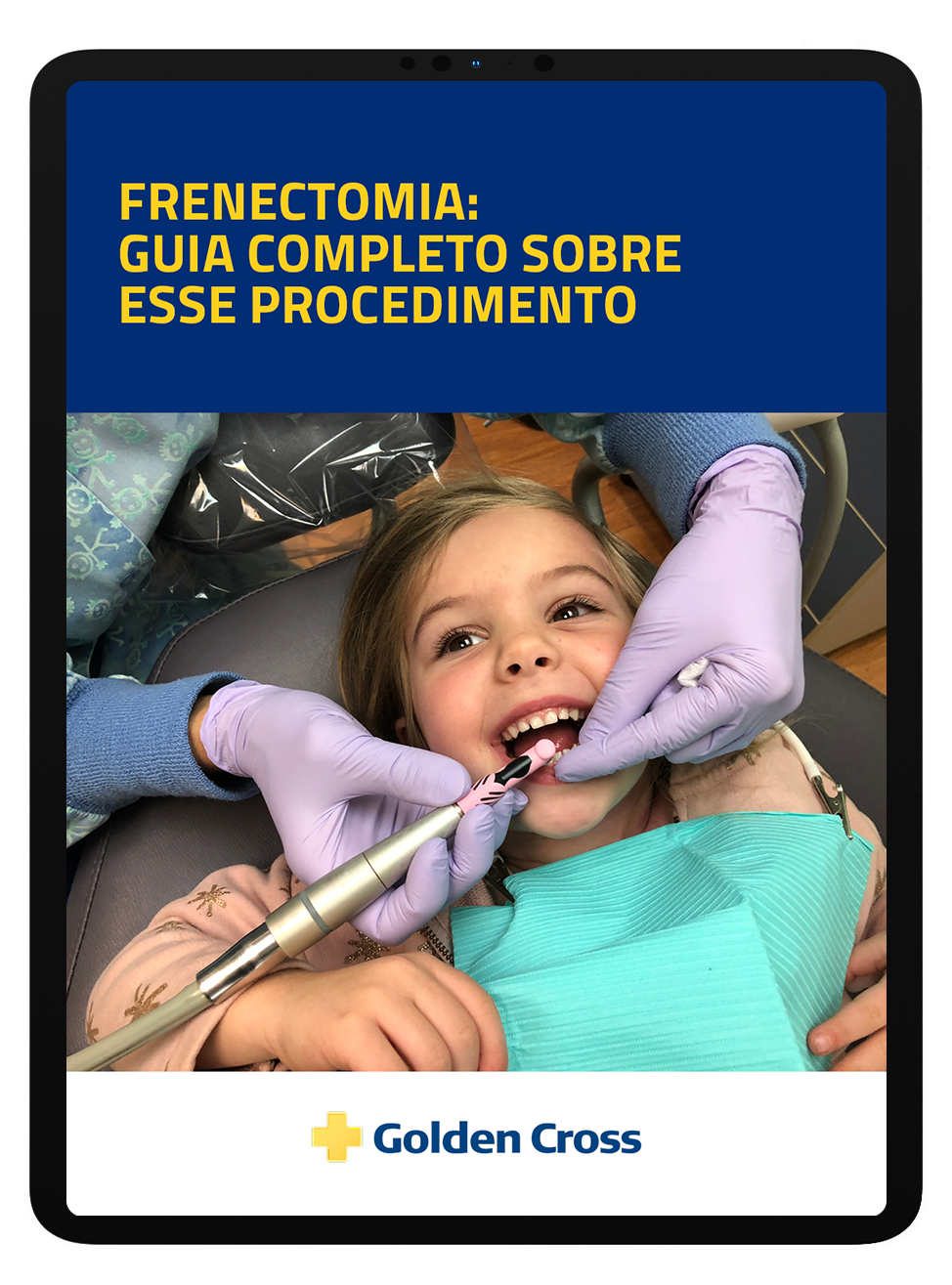 E Book Frenectomia Guia Completo Sobre Esse Procedimento